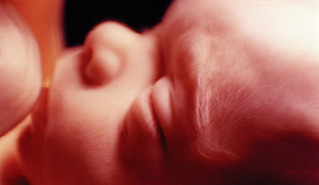 Human foetus 21 weeks from conception. From the laboratory of Collegium Medicum of the Jagiellonian University in Kraków