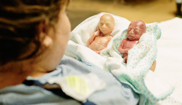 Heather Ellis miscarried her twin boys, Chase and Cooper, at 22 weeks