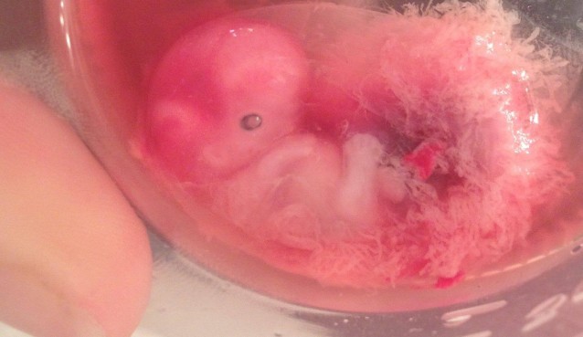 Photos of Baby 'Vincent Marie' miscarried at 7 weeks