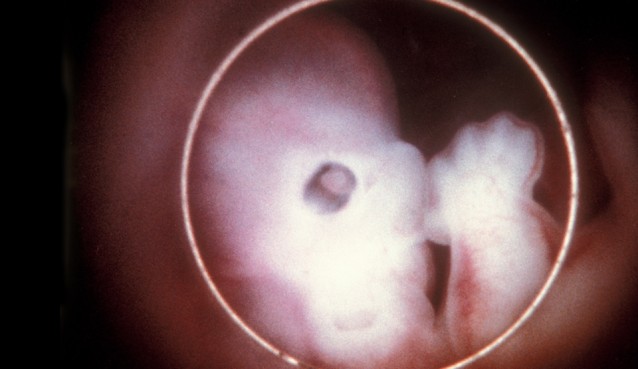 Human embryo 6 weeks from conception