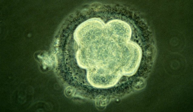 The embryo has undergone three cycles of cell division to get to this stage and the cells have not yet undergone compaction as they are still rounded. The embryo is still surrounded by the zona pellucida, the tough outer membrane. http://wellcomeimages.org/ixbin/hixclient.exe?MIROPAC=B0000021