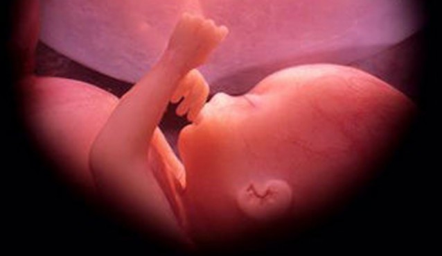 Foetus at approx 30 weeks. Used under CC Licence. http://commons.wikimedia.org/wiki/File:Feto-30-semanas.jpg