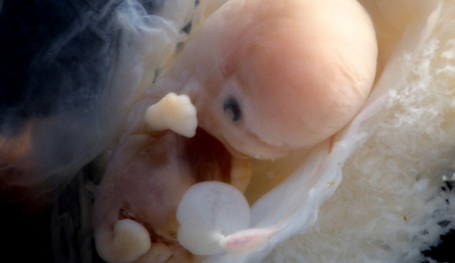 Human embryo 6 weeks from conception. https://www.flickr.com/photos/lunarcaustic/14214200980/in/set-72157617368698808