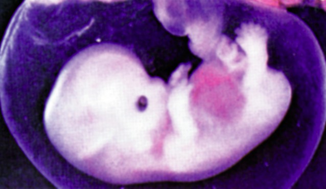 Human embryo at 6 weeks