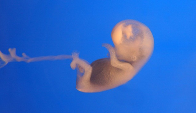 Human embryo 7 weeks after conception