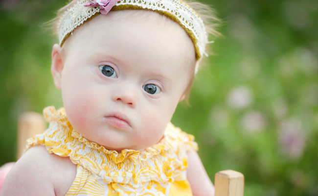 Baby girl with Down Syndrome. Photo credit - Julie Kulbago Photography. ©