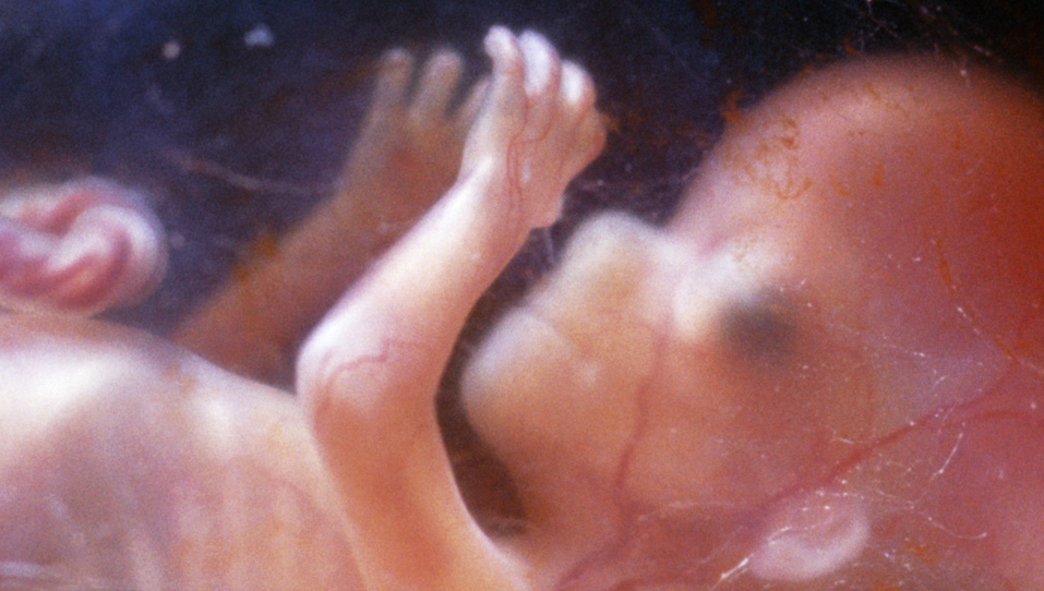 Human foetus 14 weeks after conception. Photo credit - SciencePhoto Library