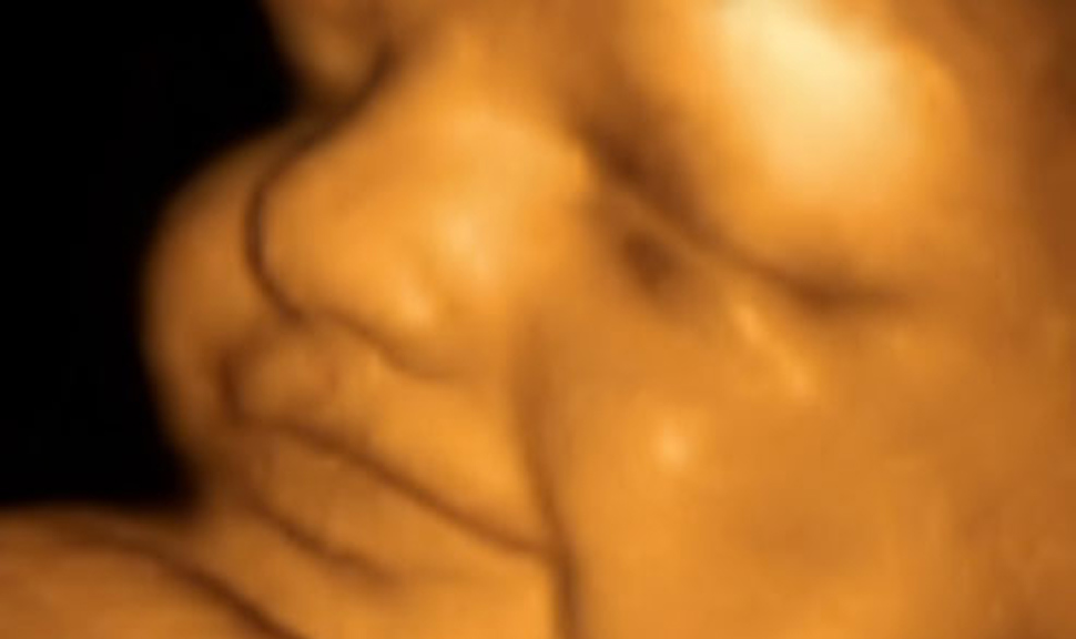 3D Ultrasound photo of a human embryo at 24 weeks from conception