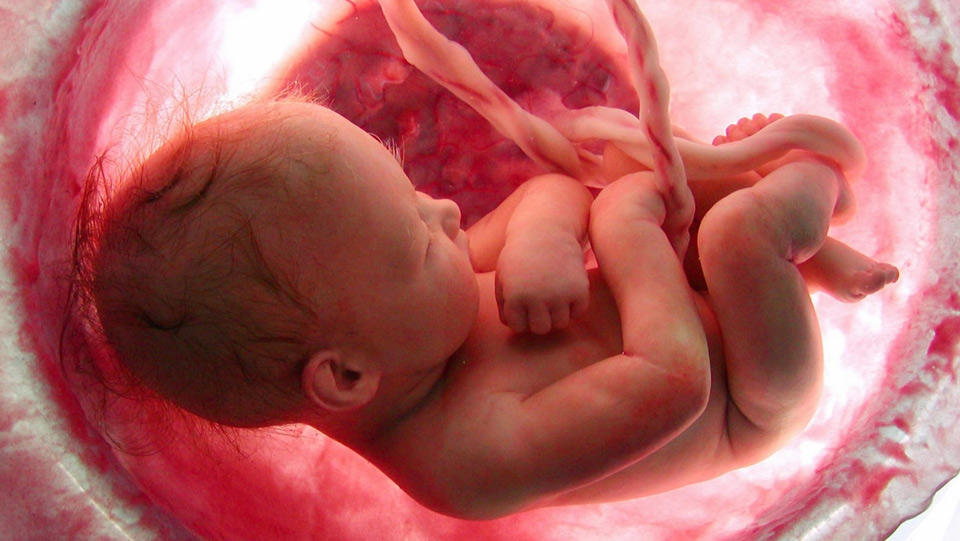 Unborn child in the womb at 36 weeks approximately