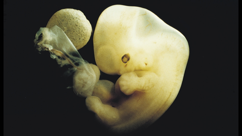 4 weeks from conception. Human embryo measuring approximately 13 mm crown to rump. The upper limbs, fingers and face are developing and growing rapidly. Photo credit - Ralph Hutchings Getty Images