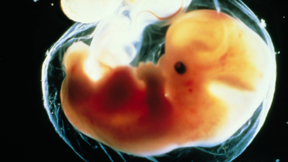 Human embryo 5-6 weeks after fertilisation. Photo Credit - Science Photo Library