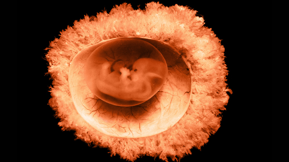 45 day old human embryo with an intact fetal membrane. Photo credit - Getty Images Omnikron Omnikron