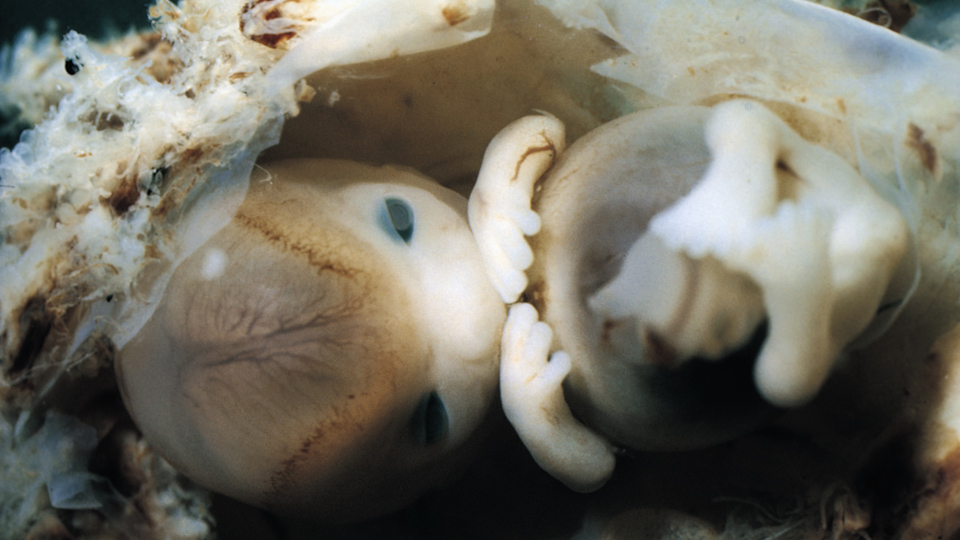 Human embryo at 7 weeks gestation, measuring approximately 14 mm (crown to rump). The eye is developing but is not functioning yet. The brain is developing. Photo Credit - Getty Images. Date taken - 1 October 2007