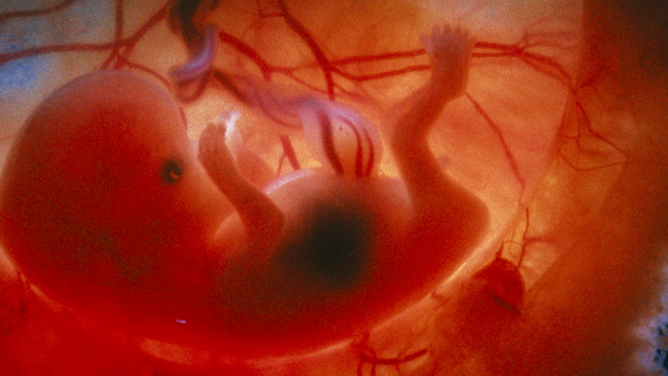 Human embryo 9 weeks from conception. Photo credit - Science Photo Library