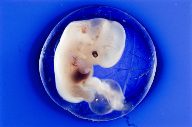Human embryo in the amniotic sac at 40 days, showing the umbilical cord and the early development of the head, eyes, feet, and hands.