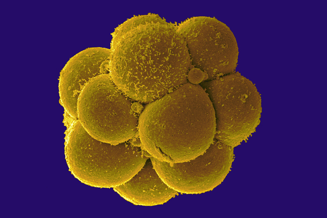 Scanning electron micrograph of a human embryo, 12-16 cell stage, day 4.