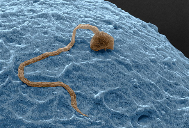 Scanning electron micrograph of a human spermatozoon (sperm)fertilizing an ovum (egg). The ovum is as thin as a hair at a size of almost 100 microns, and the microscopic spermatoz oon is only 3 microns. Courtesy of the film, Building Babies. (c) Mona Lisa