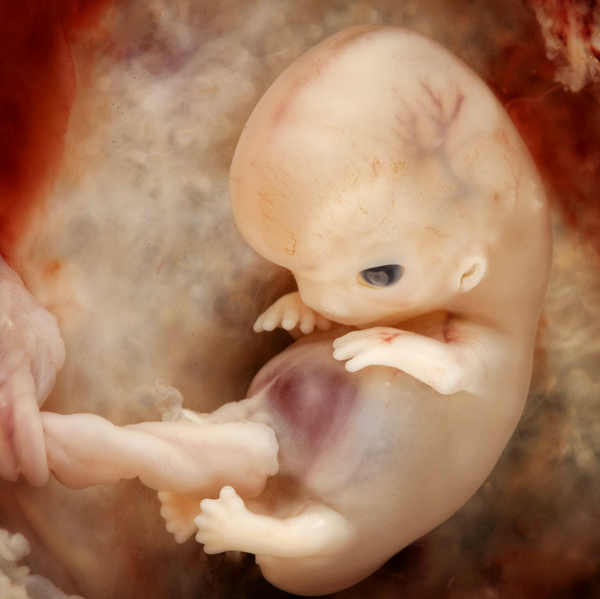 Embryo at 7 - 8 weeks