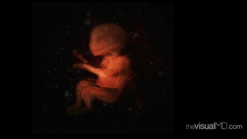 7 Month Old Fetus with Translucent Skin. Courtesy of theVisualMD. http://www.thevisualmd.com/media_gallery_slice.php?idu=11700 