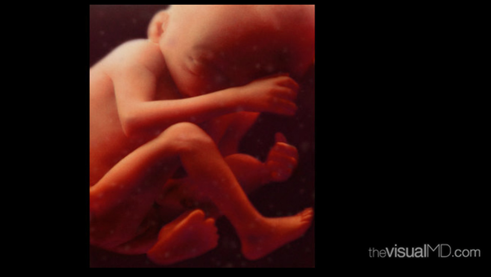 7 month old foetus. Courtesy of theVisualMD. http://www.thevisualmd.com/media_gallery_slice.php?idu=10398