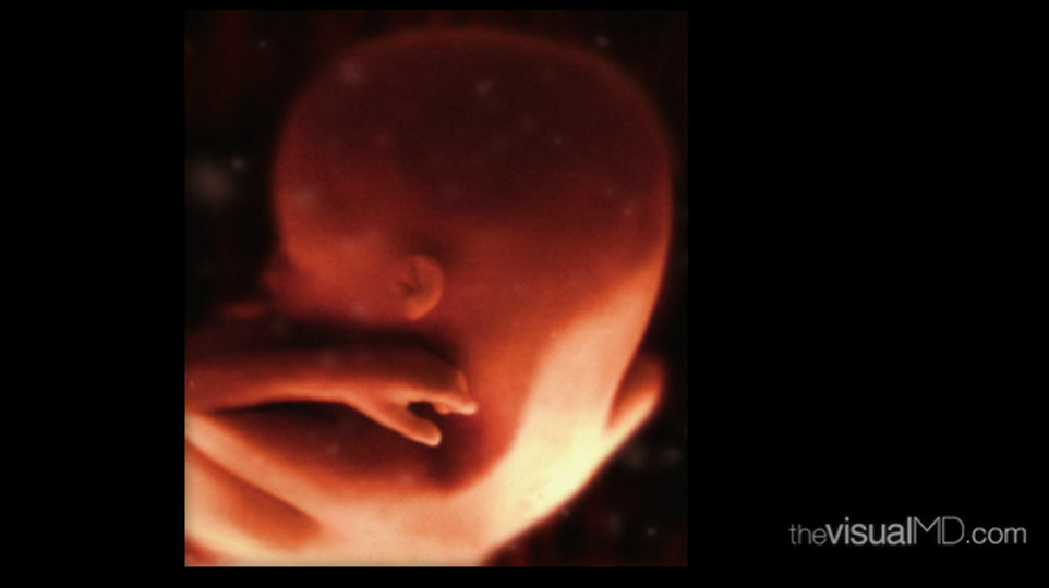 This image presents a left-sided dorsal view of a 16-week-old fetus. Courtesy of theVisualMD. http://www.thevisualmd.com/media_gallery_slice.php?idu=10368