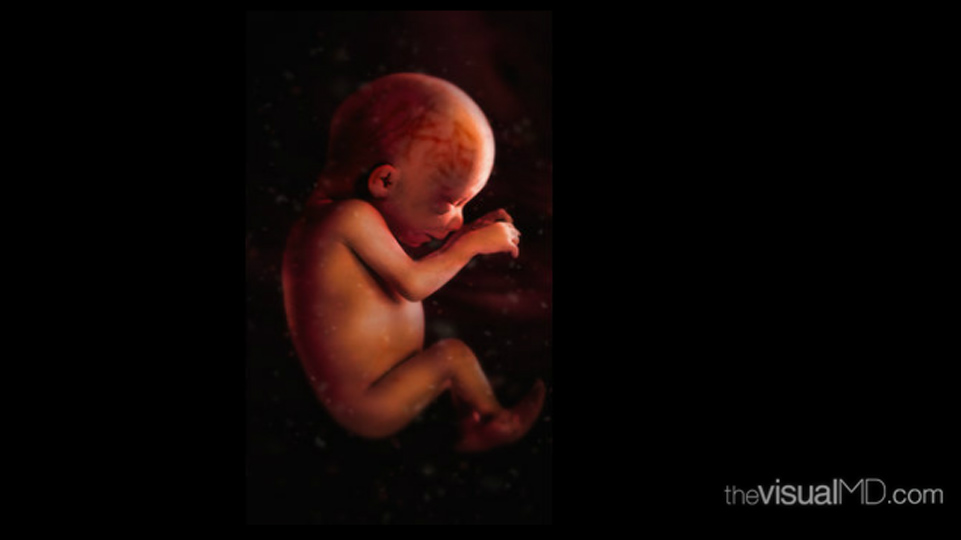 Foetus at 28 weeks. The developing ear can be distinguished on the right side of the head. The eye is visible and is partially open. When the eyelids fuse, the eyes close for a period of time until around the twenty-sixth week of fetal development. Courtest of theVisualMD. http://www.thevisualmd.com/media_gallery_slice.php?idu=10397